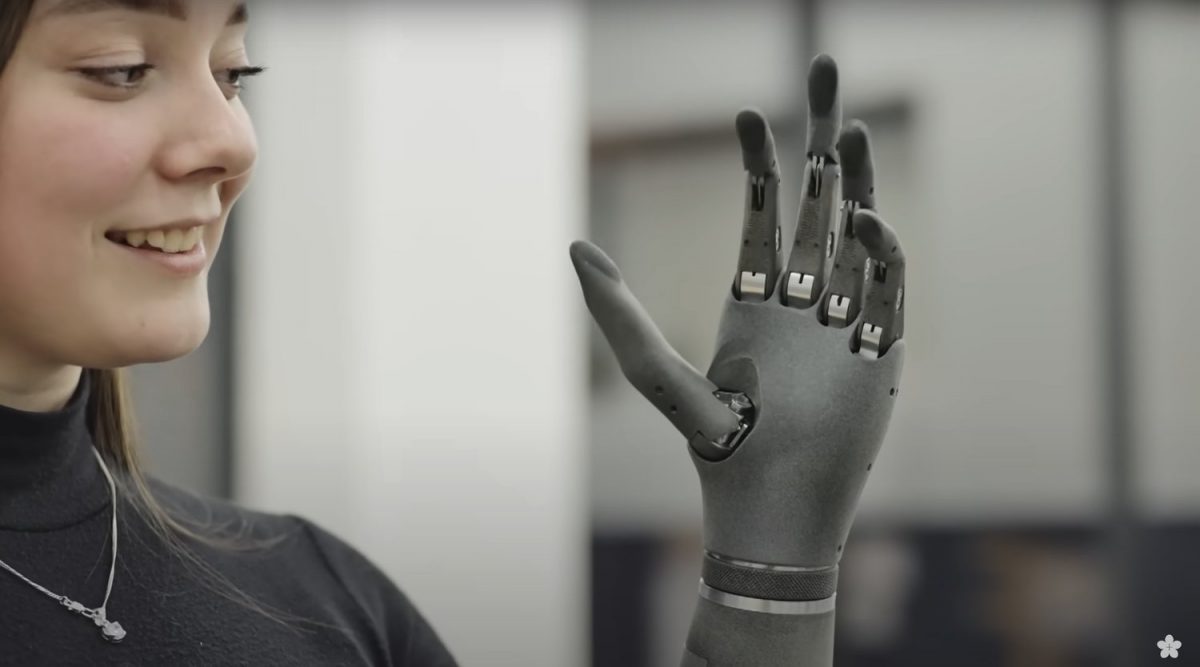 Check Out This Cool Robotic Prosthetic Hand That’s Powered by AI — GeekTyrant